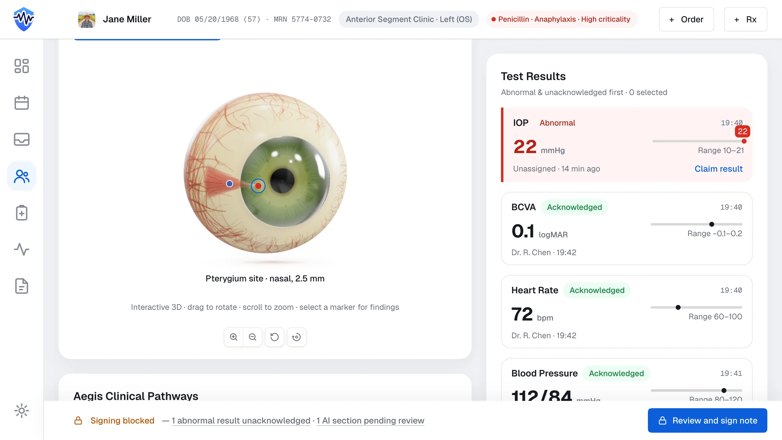 The settled record after load: eye stage still, hotspot markers quiet, result dots at rest