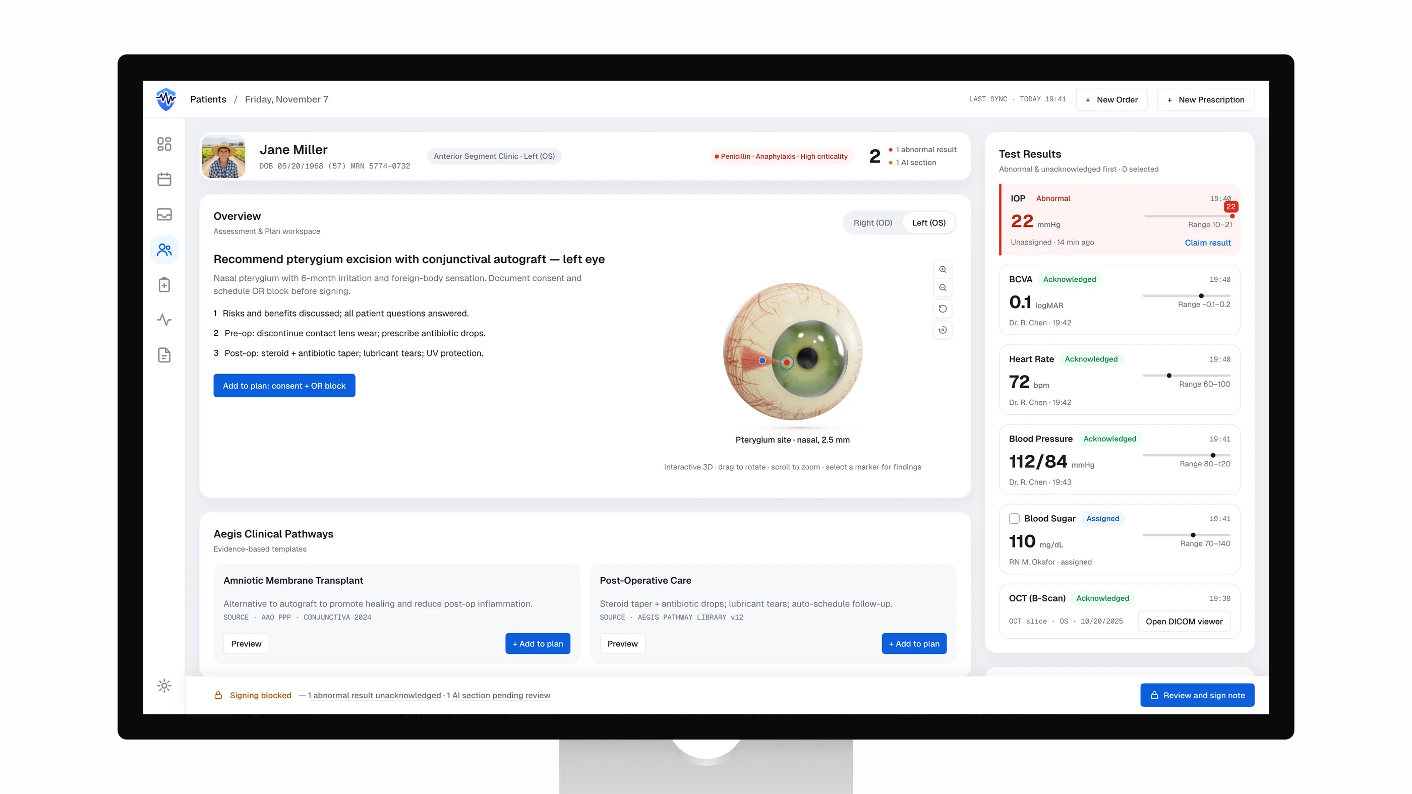 Aegis clinical workstation on a monitor: patient header with allergy chain, pterygium plan, procedural 3D eye, and results queue
